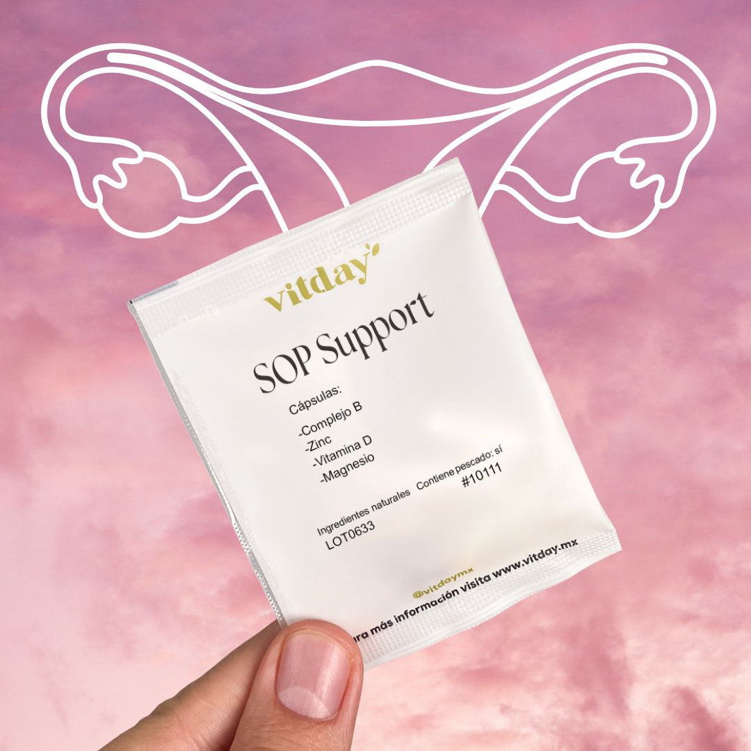 SOP Support
